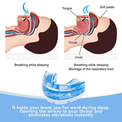 Adjustable Anti Snore Mouthpiece